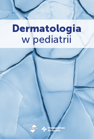Dermatologia pediatryczna: diagnostyka i terapia chorób skóry